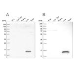 HRSP12 Antibody in Western Blot (WB)