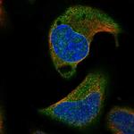 AARSD1 Antibody in Immunocytochemistry (ICC/IF)