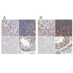 PFAS Antibody in Immunohistochemistry (IHC)