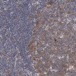 PFAS Antibody in Immunohistochemistry (IHC)