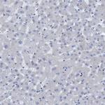 NMT1 Antibody in Immunohistochemistry (IHC)