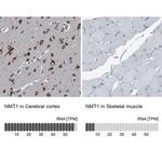 NMT1 Antibody