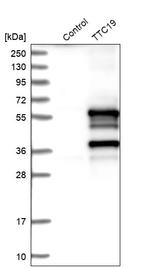 TTC19 Antibody in Western Blot (WB)