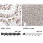 RNMTL1 Antibody in Immunohistochemistry (IHC)