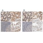 RNMTL1 Antibody in Immunohistochemistry (IHC)