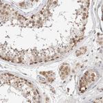 RNMTL1 Antibody in Immunohistochemistry (IHC)