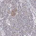 EFR3A Antibody in Immunohistochemistry (IHC)