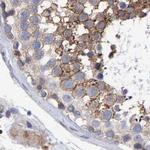 EFR3A Antibody in Immunohistochemistry (IHC)