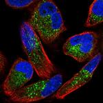 ZNF624 Antibody in Immunocytochemistry (ICC/IF)