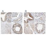 SLC38A10 Antibody in Immunohistochemistry (IHC)