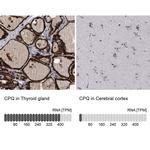 PGCP Antibody in Immunohistochemistry (IHC)