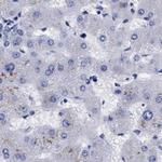 Arylsulfatase G Antibody in Immunohistochemistry (IHC)