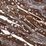 C17orf25 Antibody in Immunohistochemistry (IHC)