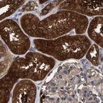 C17orf25 Antibody in Immunohistochemistry (IHC)