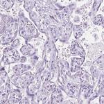 WDR16 Antibody in Immunohistochemistry (IHC)