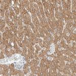 ALDH7A1 Antibody in Immunohistochemistry (IHC)