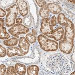 ALDH7A1 Antibody in Immunohistochemistry (IHC)