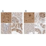 TOM1L2 Antibody in Immunohistochemistry (IHC)