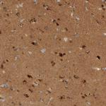 TOM1L2 Antibody in Immunohistochemistry (IHC)