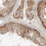 TOM1L2 Antibody in Immunohistochemistry (IHC)