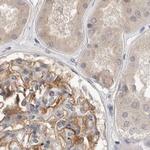 TOM1L2 Antibody in Immunohistochemistry (IHC)