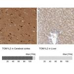 TOM1L2 Antibody