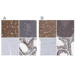 Septin-7 Antibody in Immunohistochemistry (IHC)