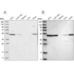 Septin-7 Antibody in Western Blot (WB)