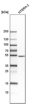 Septin-7 Antibody in Western Blot (WB)