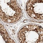 CNTROB Antibody in Immunohistochemistry (IHC)