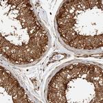 CNTROB Antibody in Immunohistochemistry (IHC)