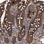 GGT6 Antibody in Immunohistochemistry (IHC)