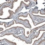 PCM1 Antibody in Immunohistochemistry (IHC)