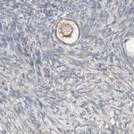 PCM1 Antibody in Immunohistochemistry (IHC)