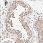 PCM1 Antibody in Immunohistochemistry (IHC)