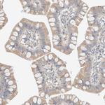 PCM1 Antibody in Immunohistochemistry (IHC)