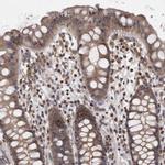 PCM1 Antibody in Immunohistochemistry (IHC)