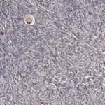 PCM1 Antibody in Immunohistochemistry (IHC)