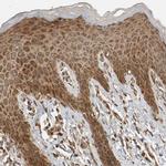 ZFAND1 Antibody in Immunohistochemistry (IHC)