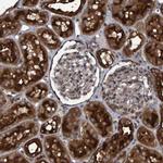 V-ATPase H Antibody in Immunohistochemistry (IHC)