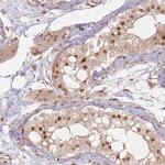 KLHL36 Antibody in Immunohistochemistry (IHC)