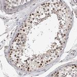 ACRC Antibody in Immunohistochemistry (IHC)