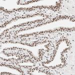 SON Antibody in Immunohistochemistry (IHC)