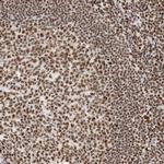 SON Antibody in Immunohistochemistry (IHC)