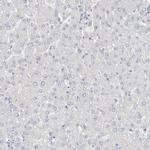 DUOX1 Antibody in Immunohistochemistry (IHC)