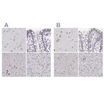 RUNDC3A Antibody in Immunohistochemistry (IHC)