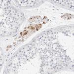 GADD45G Antibody in Immunohistochemistry (IHC)