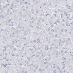 CDH17 Antibody in Immunohistochemistry (IHC)