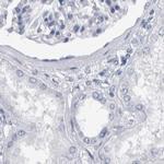 CDH17 Antibody in Immunohistochemistry (IHC)