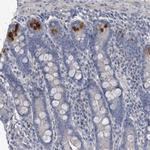 TTYH1 Antibody in Immunohistochemistry (IHC)